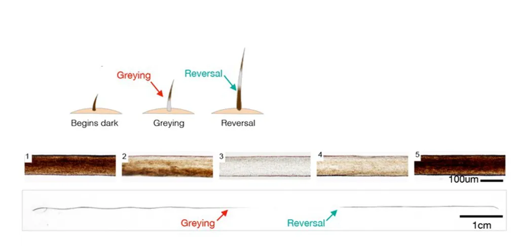 Human hair greying and reversal