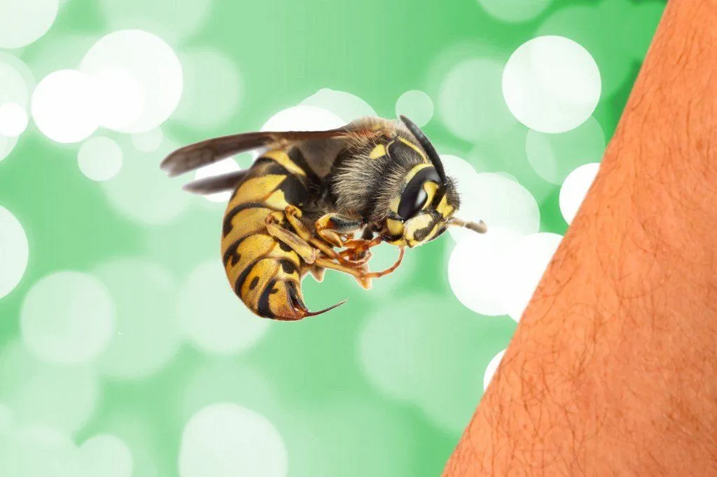 Why Does A Bee-Sting Hurt So Much And What Can You Do About It?