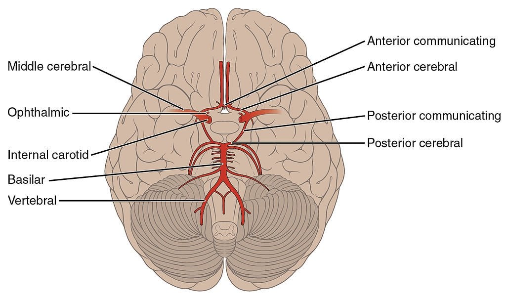 Arteries of the Brain