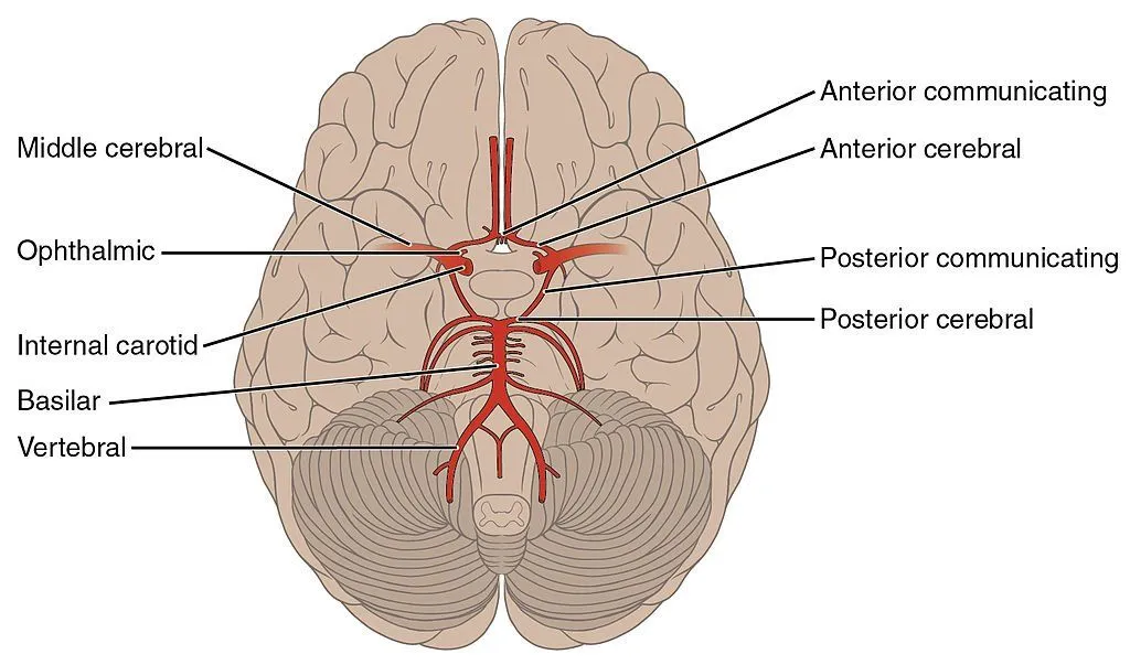 Arteries of the Brain