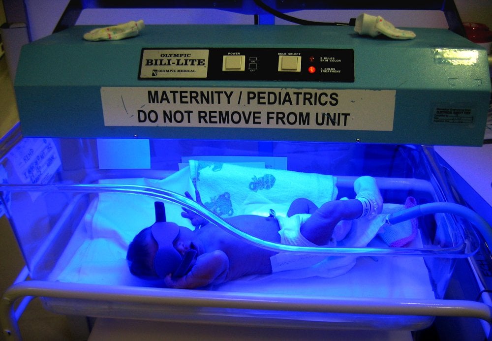 Bili light with newborn