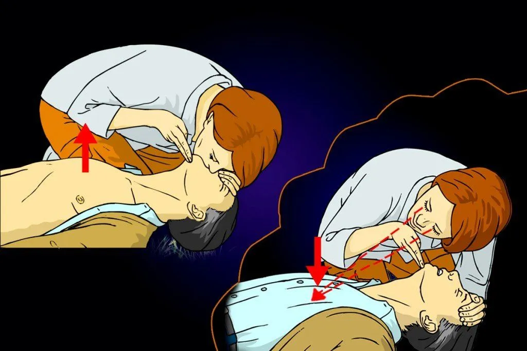 Kiss Of Life: What Is Mouth To Mouth Artificial Respiration? How It Works