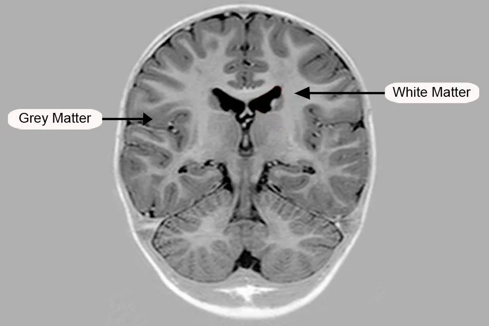 black & white matter