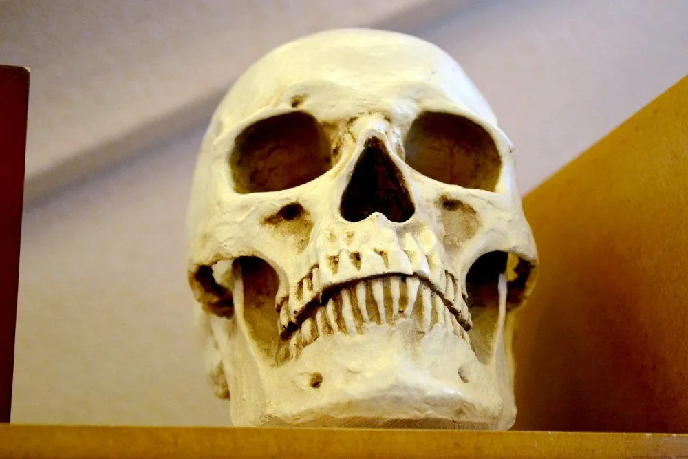 Which Bones Make Up Our Skull?