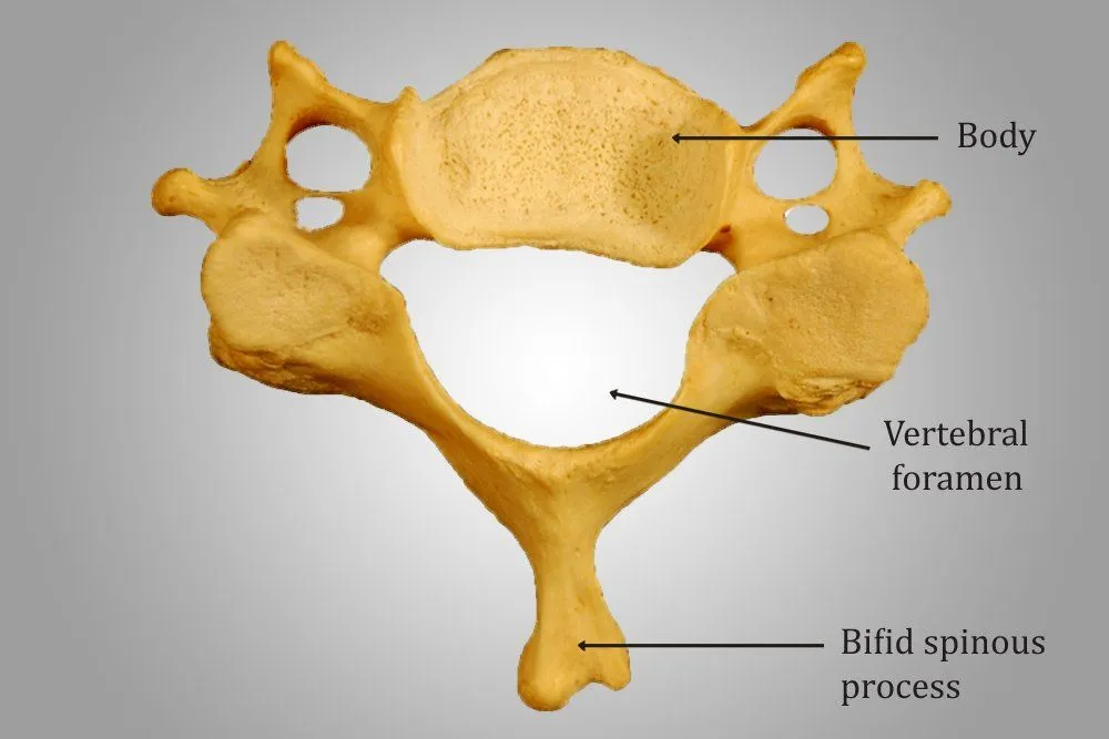 Cervical vertebra
