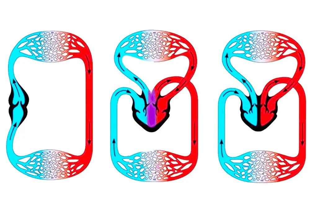 Two &Amp; Three Chambered Hearts: How Do They Work?