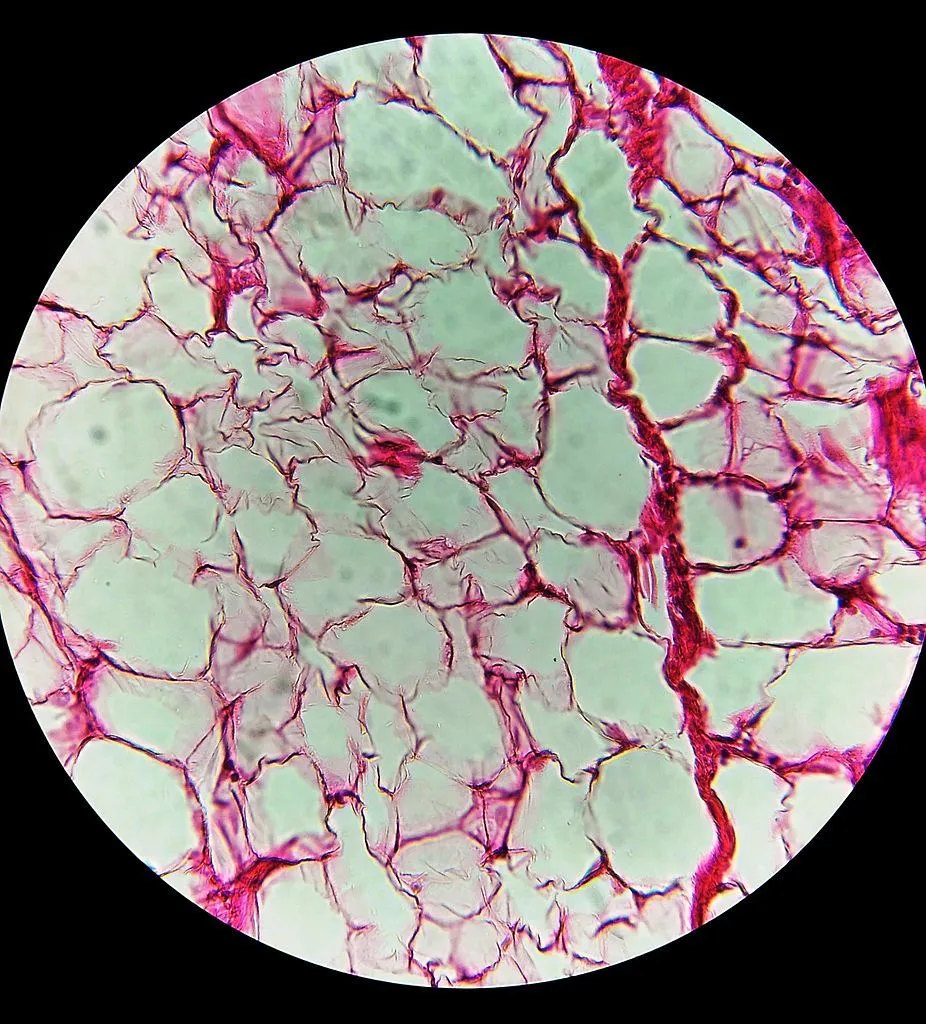 White adipose tissue