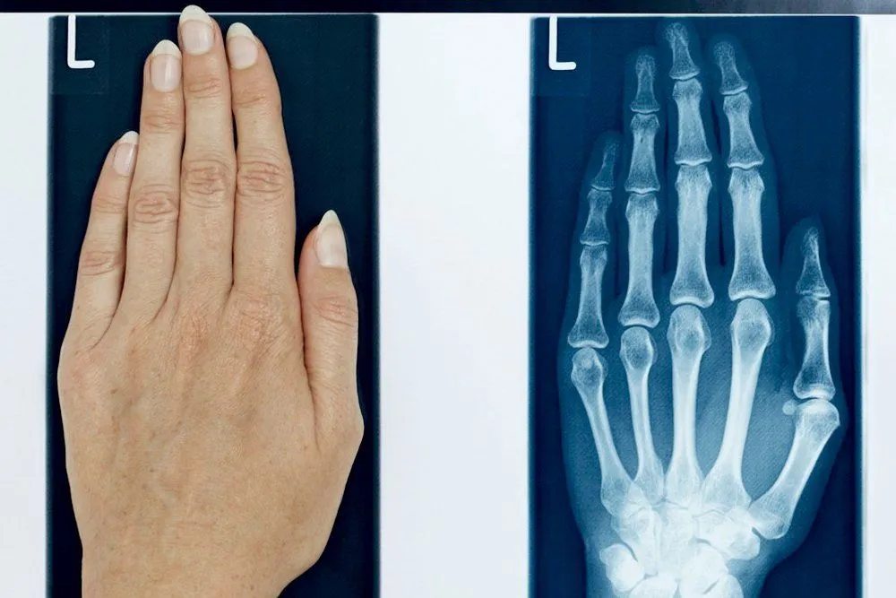 X Ray: Definition, Properties, History And Applications