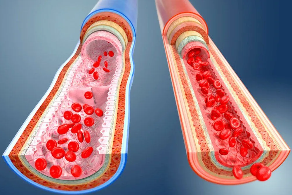 What Are Arteries, Veins And Capillaries?