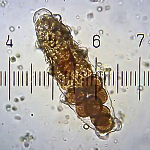 Size of a female tardigrade bearing eggs in its body (Image Credits: Wikipedia.org)
