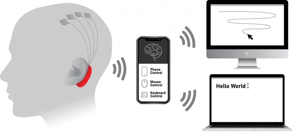 Implantable brain–machine interface with chronic electrode implant, neural-control interface, brain–computer interfac(skvalval)s