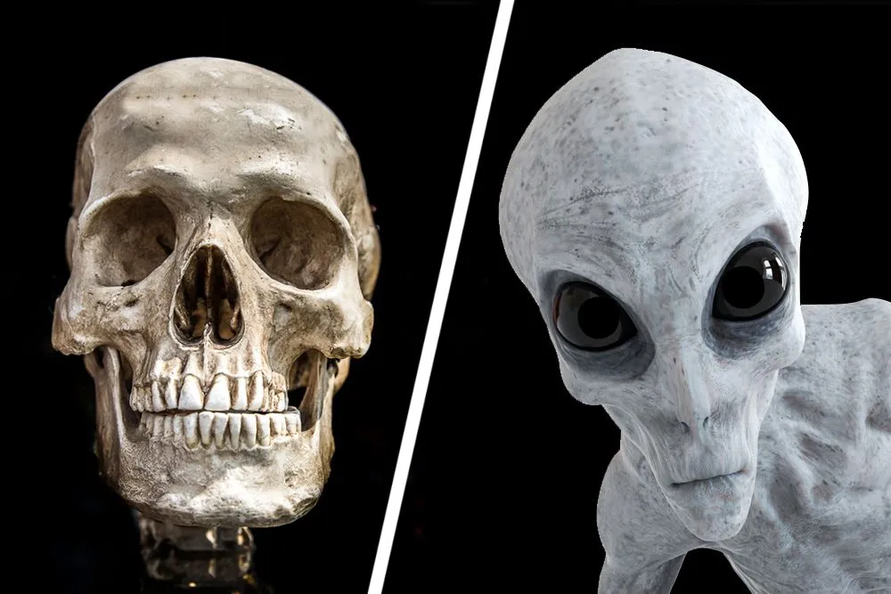 Are Elongated Skulls Linked To Aliens?