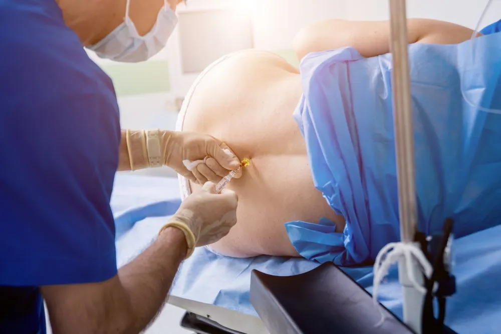 Epidural: Definition, Procedure, Medication, Injection, Pain, & Side Effects
