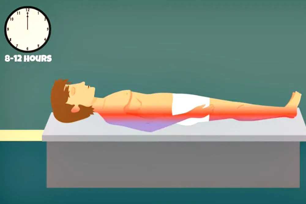 Livor Mortis: Definition, Causes, And Timeline