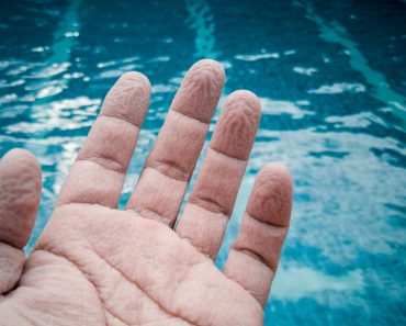 wrinkled hand because of soak in the water for a long time(SharkPaeCNX)S