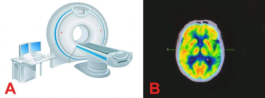 Computed Tomography Scanner with two processes of absorption the photoelectric effect and Compton Effect &Compton Effect Scattering