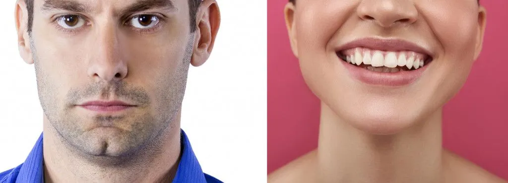 (Cleft chin (dominant) vs Chin without a cleft (recessive)