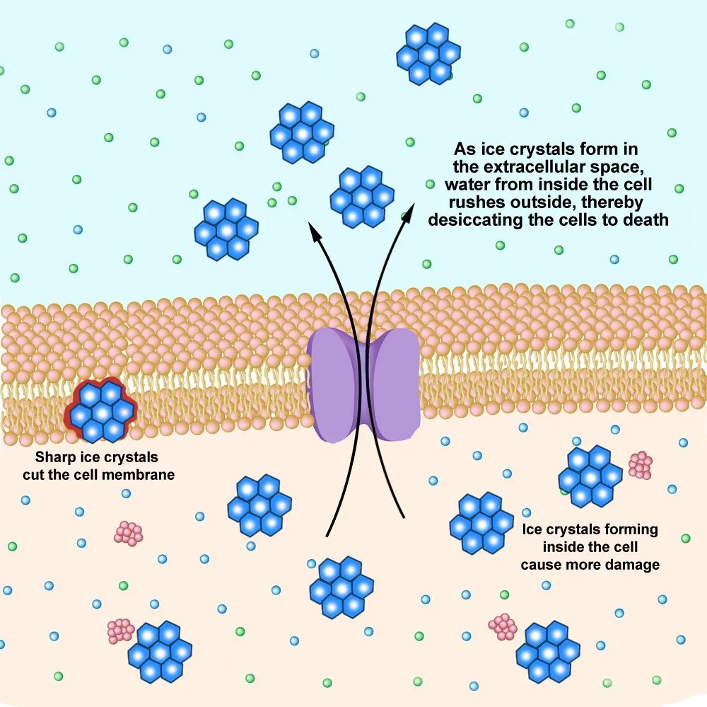 Ionic,Basis,Of,Resting,Membrane,Potential, CELL-IMAGE-DEPICTING-DAMAGE-FROM-ICE-1.jpg