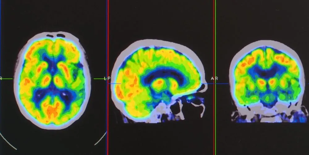An,Array,Of,Positron,Emission,Tomography,Or,Pet,Images,Showing