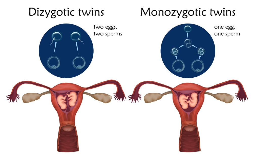 Multiple pregnancy. Dizygotic and monozygotic twins, embryo, fetus in uterus, placenta, umbilical cord, egg, sperm. Vector medical illustration. Colored image, white background.