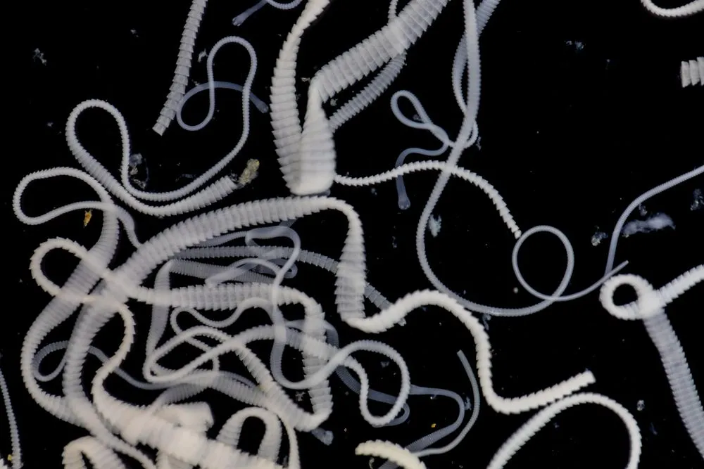 The,Study,Of,Tapeworm,Infection,Is,Caused,By,Ingesting,Food