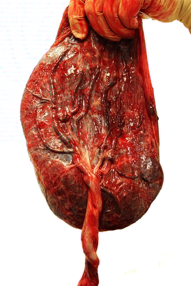 Placenta,On,White,Background