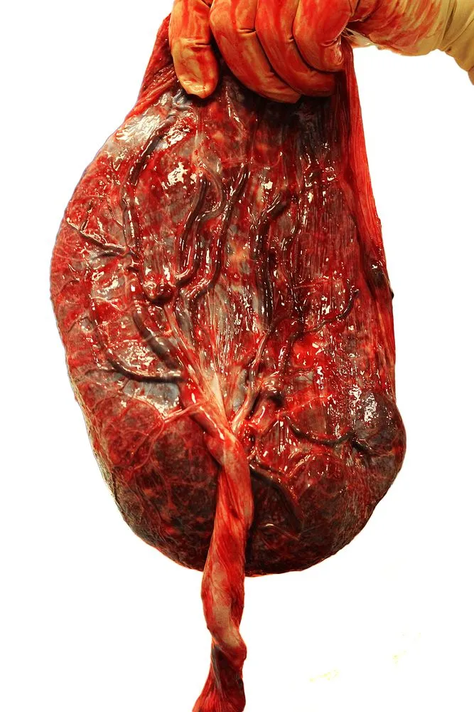 Placenta,On,White,Background