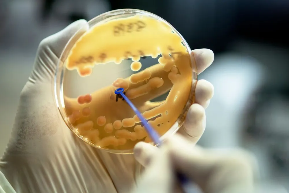 If We Can Grow Bacteria In A Lab, Why Do We Only Know About 1% Of Them?