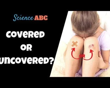 Do Wounds Heal Faster Covered Or Uncovered?