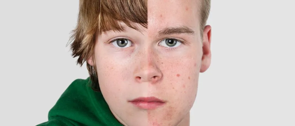 How Does The Body Know When To Start Puberty?