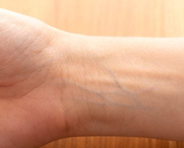 Human,Wrist,With,Blue,Veins,Visible,Through,Skin,Close,Up