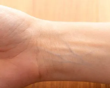 Human,Wrist,With,Blue,Veins,Visible,Through,Skin,Close,Up