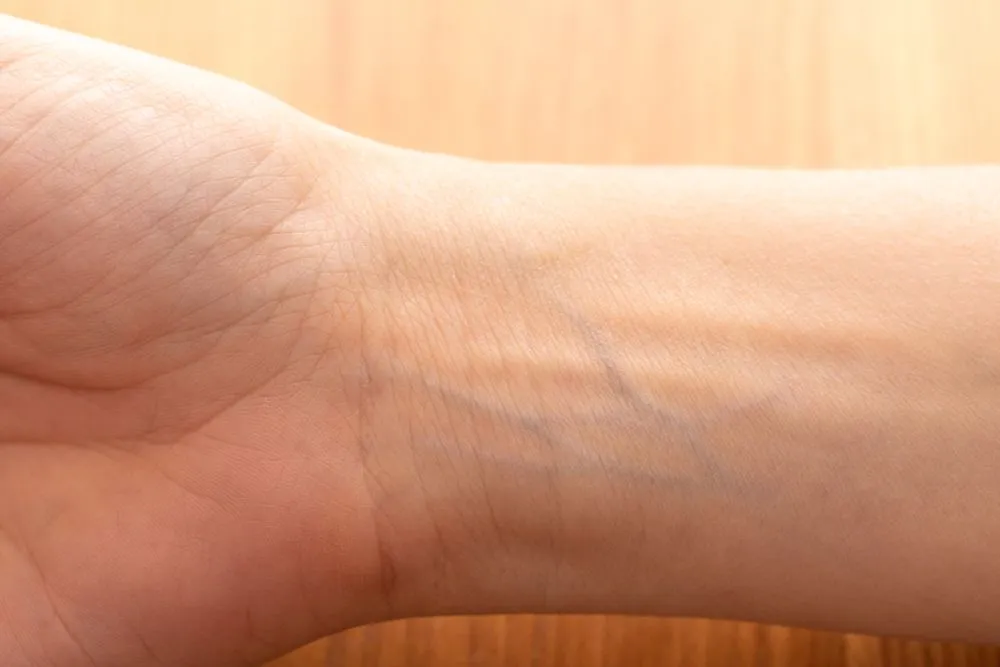 If Blood Is Red, Why Do Veins Appear Blue Through The Skin?
