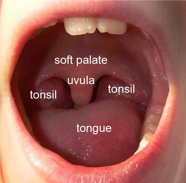The location of the uvula in your mouth. (Credit: Lamiot/Wikimedia Commons)