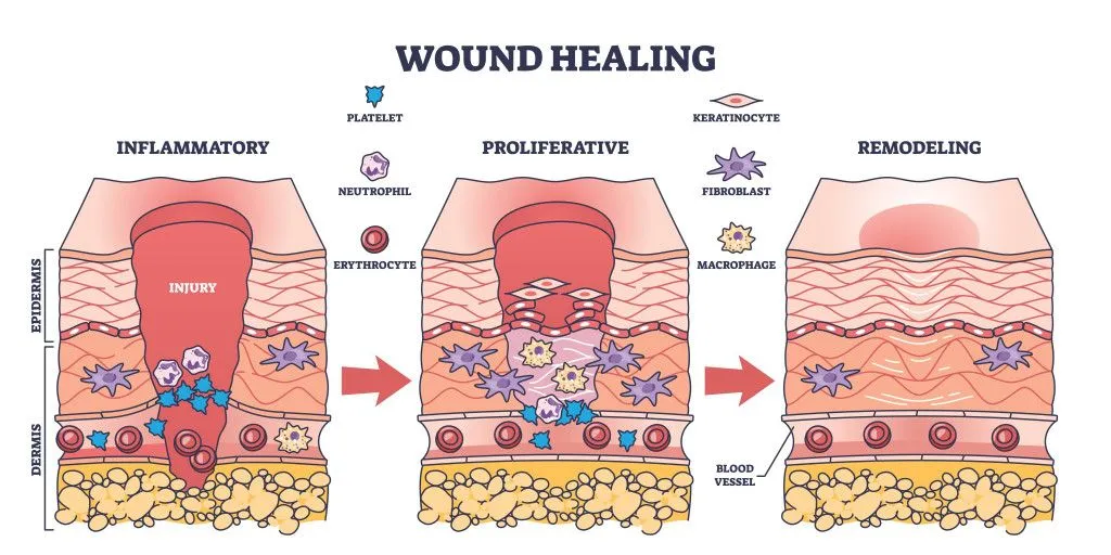 The inflammatory, proliferation and remodeling phases of the wound healing process (Credits: VectorMine/Shutterstock)