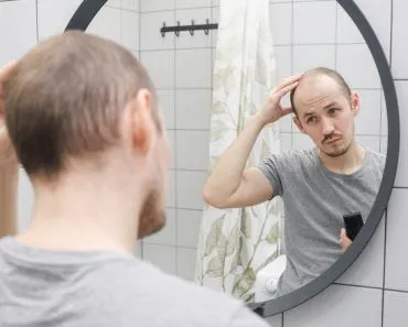 Why Do Men Often Go Bald, But Women Rarely Do?