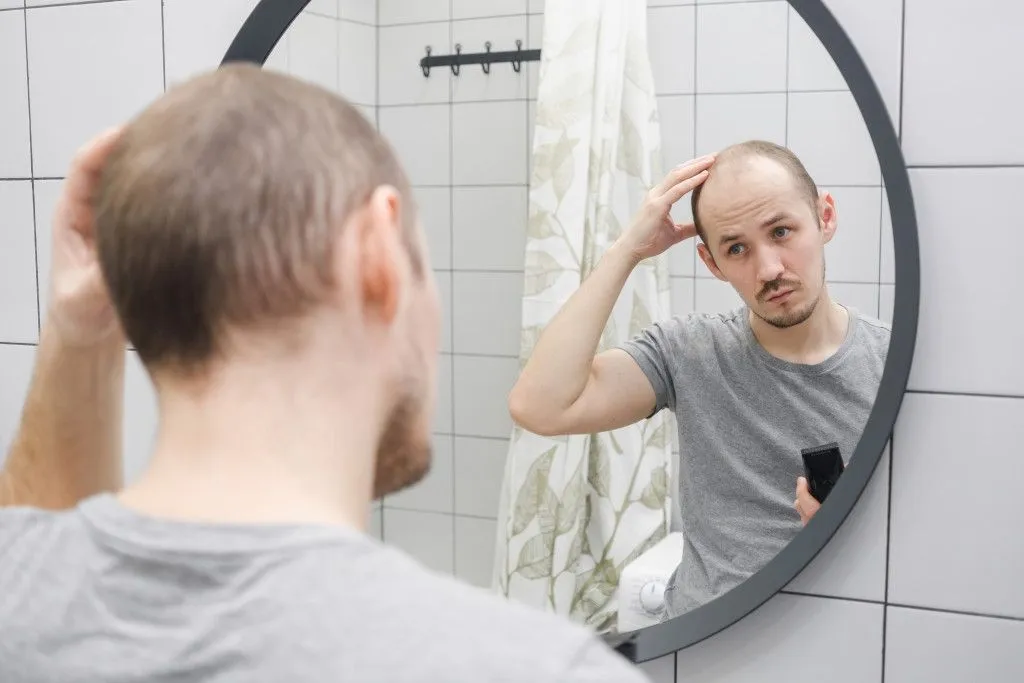 Why Do Men Often Go Bald, But Women Rarely Do?