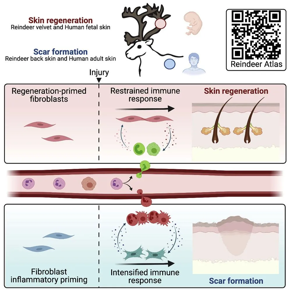 Fetal skin and reindeer antler skin heal without scars, while human adult skin and reindeer back-skin show scarring upon injury (Credits: Sinha, S., Sparks, H. D., Labit, E., Robbins, H. N., Gowing, K., Jaffer, A., … Biernaskie, J. (2022, December). Fibroblast inflammatory priming determines regenerative versus fibrotic skin repair in reindeer. Cell. Elsevier BV. http://doi.org/10.1016/j.cell.2022.11.004 )