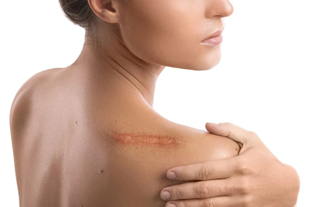 Big wounds leave scars after they heal (Credits: Photohobo/Envato Elements)