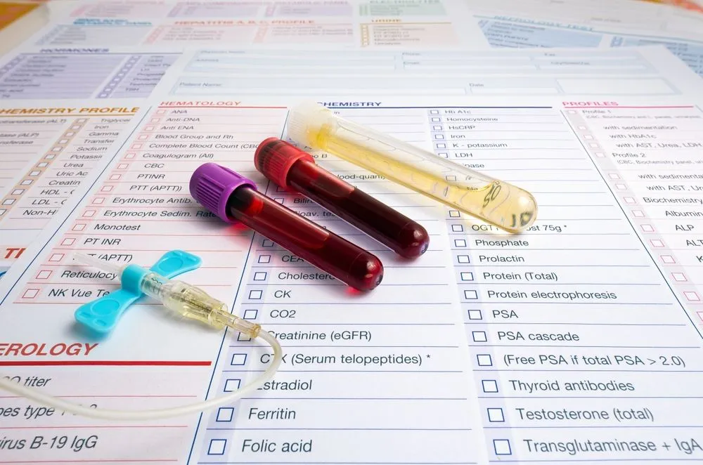 Biomarkers are measurable indicators of any biological process within the body. They are usually measured from easily accessible sources like blood, urine, saliva or even tissue like hair (Credits: angellodeco/Shutterstock)