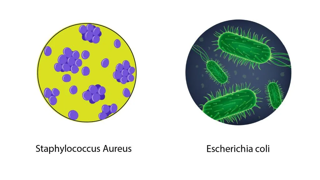 E.coli and Staphylococcus aureus are the most predominant bacteria found on the phone.