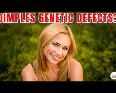 Are Dimples 'Genetic Defects?'